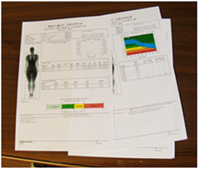 골밀도검사사진